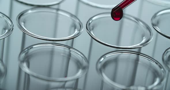 Blood Test In The Lab alt