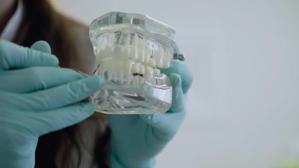 Dentist's Hands Showing Features of Dental Problems on Jaw Layout at Camera alt