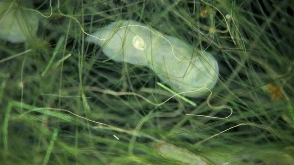 Worm Aeolosoma Sp alt