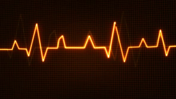 Medical pulse trace animation alt