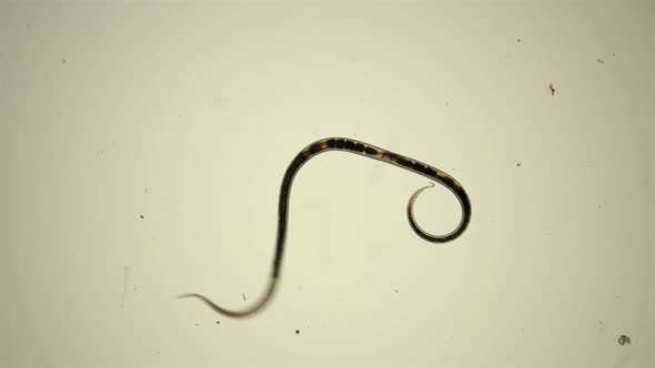 Black Sea Plankton and Zooplankton Under the Microscope, Sea Worm Nematode alt