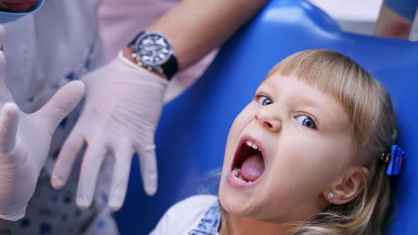 Little child in stomatology chair opens her mouth wide and shows her teeth to the doctor alt