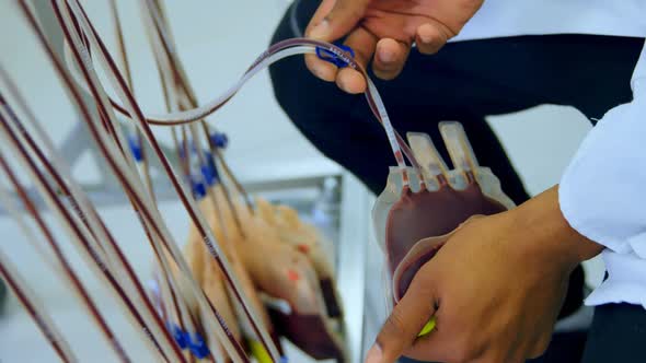 Laboratory technician analyzing blood bag 4k alt