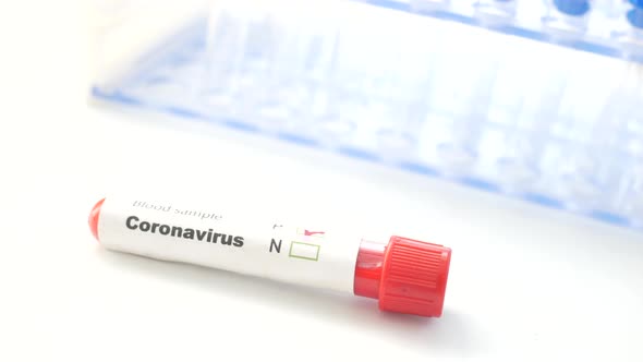 Close Up of Corona Virus Blood Test Tube on White Background alt