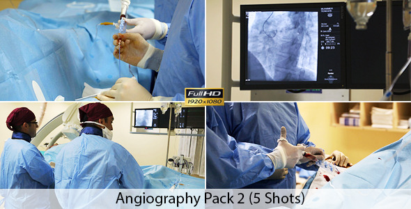 Angiography alt
