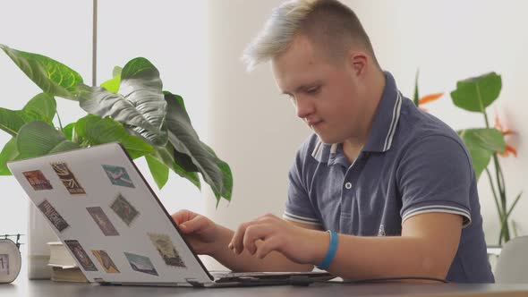 Teenager Boy with Down Syndrome with Blue Hair is Working on Laptop