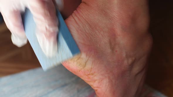Close-up of a hand rubbing a pumice stone on the heel of the foot with dry skin, foot heel care, cos alt