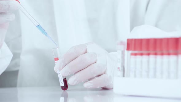 Close up laboratory worker hands work with blood sample in tube.