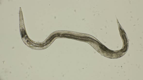 Movement of Formed Roundworms Turbatrix Aceti Inside the Female, Stock ...