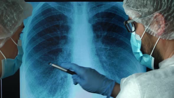 X-ray of Patient with Lung Pneumonia, Doctors at Computer Discuss Lungs Are Affected By Virus