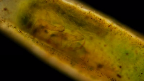 Trichoptera Larvae Under the Microscope alt