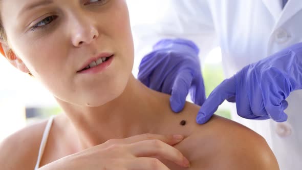 Woman therapist pointing a mole of her patient alt
