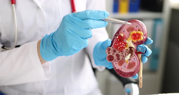 Urology and Treatment of Kidney Disease Slow Motion  Movie alt