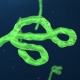 Ebola Virus - VideoHive Item for Sale