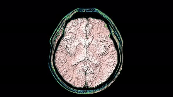 Bulk Multicolored MRI Scans of the Brain and Head To Detect Tumors. Diagnostic Medical Tool alt