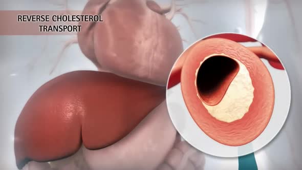 Reverse Cholesterol Transport Revisited 3d medical alt