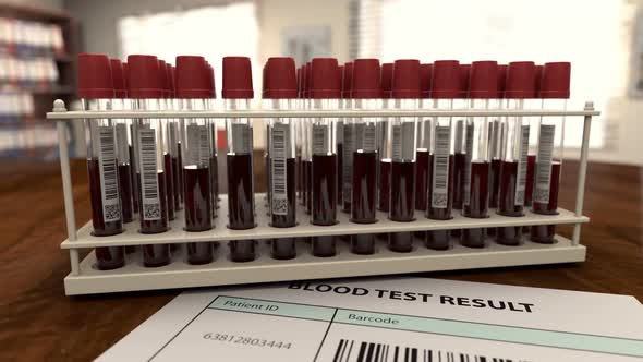 Medical Form with Virus Positive Blood Analysis alt
