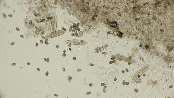 a Large Colony of Ciliates Coleps, Which Are Largely Located in Dirty Water Under a Microscope alt