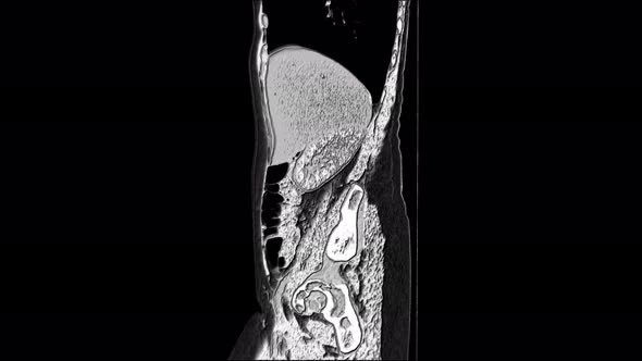 Contrast MRI of the Abdominal Cavity, Gastrointestinal Tract, Bladder alt