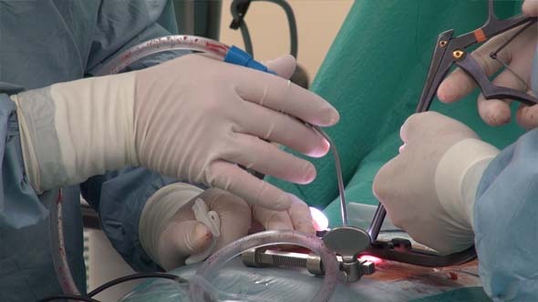 Spine Surgery, Spinal Disc Herniation 5 alt