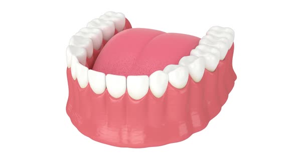 Lower jaw with gums recession process
