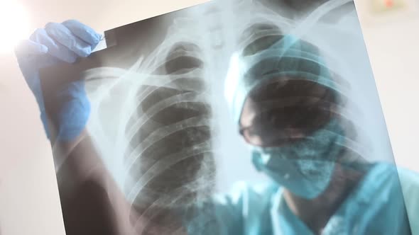 Doctor holding and analyzing an x-ray of some lungs