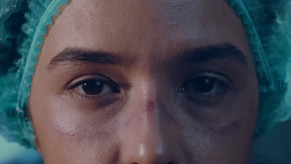 Nurse shows the wounds rubbed with protective mask after shift in hospital alt