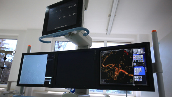 Heart Monitor EKG Coronary Angiography
