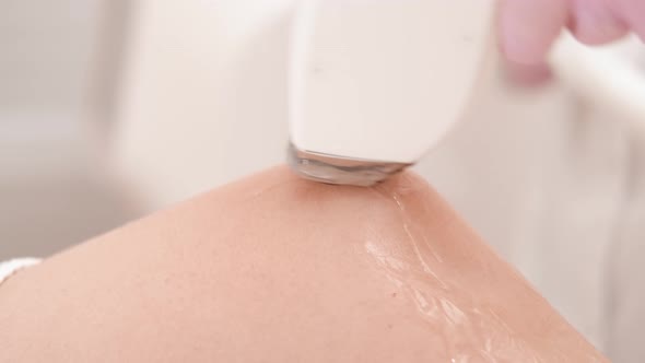 Flash of Diode Laser on Girl Knee Hair Removal Beautician Removes Hair on Beautiful Female Legs Hair alt