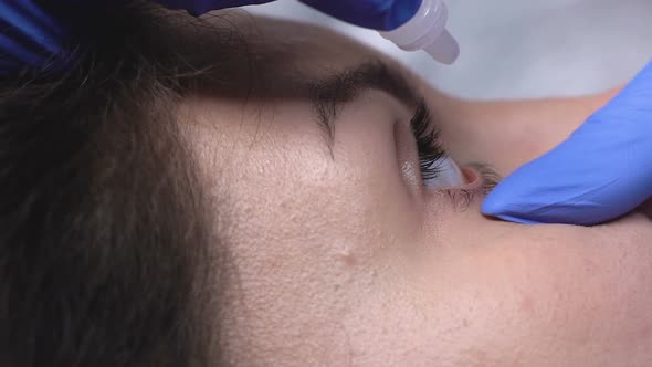 Eye Doctor Dripping Medicine in Woman Eye to Relieve Fatigue alt