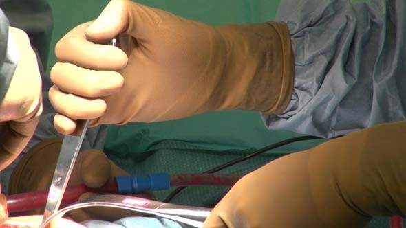 Hip Replacement and Doctor's Hands 2 alt