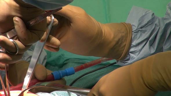 Hip Replacement and Doctor's Hands 3 alt