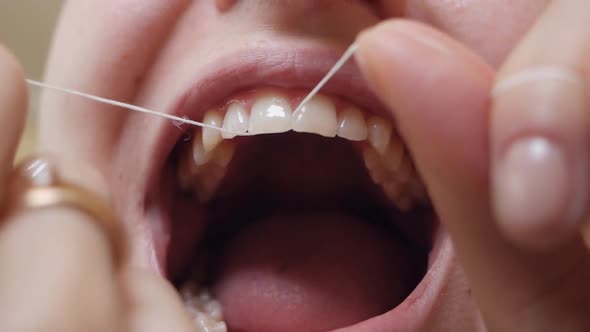 Closeup Shot of a Woman Flossing Her Teeth While Removing Leftover Food From the Interdental Space