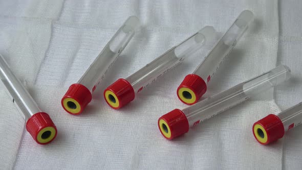 Plastic test tubes with caps for the collection of samples. Medical modern medicine