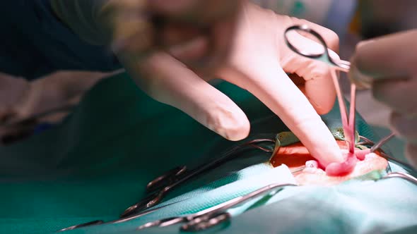 Surgeons Team Hands Performing Surgery. Close Up. alt