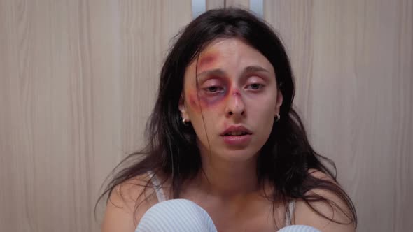 Woman with Bruise Eye Suffering alt