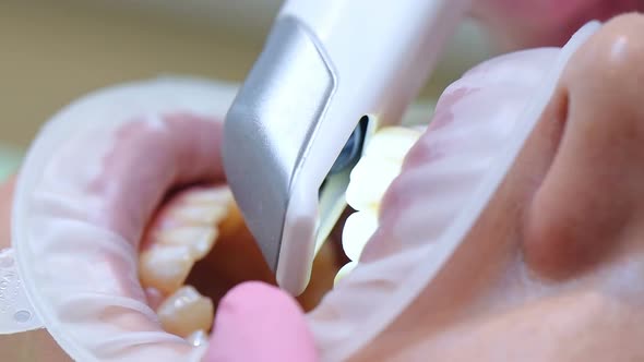 Orthodontist Scaning Patient's Teeth With Dental Intraoral Scanner