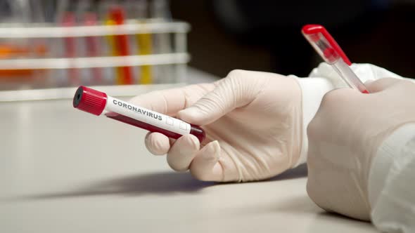 Scientist Marking Coronavirus Test Tube