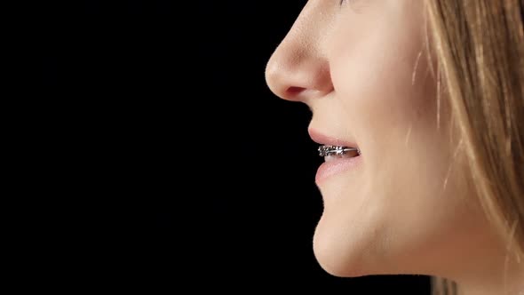 Girl in Profile with Braces Smiling. Black alt