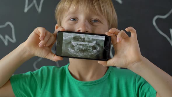Closeup Shot of a Little Boy with Missing Milk Teeth Showing His X-ray Dental Picture. Concept of alt