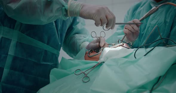 The Doctor Performs a Pediatric Surgical Operation to Remove the Tonsils alt