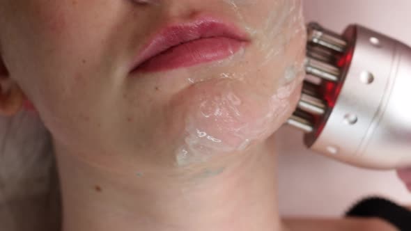 Cosmetologist Making Biolifting Rflifting Procedure alt