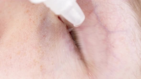 Closeup Young Man Drops Eye Drops Install Lenses Moisturizing Using Medical Eyes Drops Suffering alt