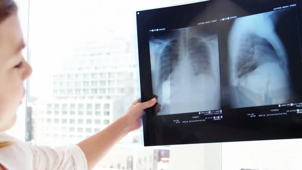 Girl examining x-ray alt
