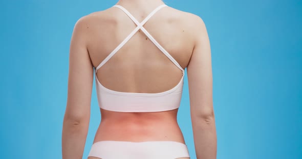 Studio Shot of Female Body with Red Inflamed Pulsating Small of the Back Blue Background alt
