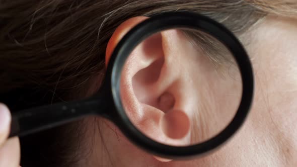 Dermatologist Examines a Large Mole in the Patient's Ear Using a Magnifying Glass alt