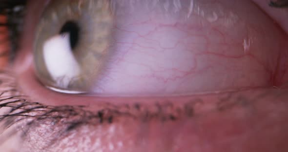 Gray Eye Looking Around and Blinking alt