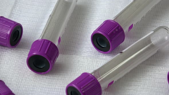 Plastic test tubes with violet caps for the collection of samples. Medical modern medicine