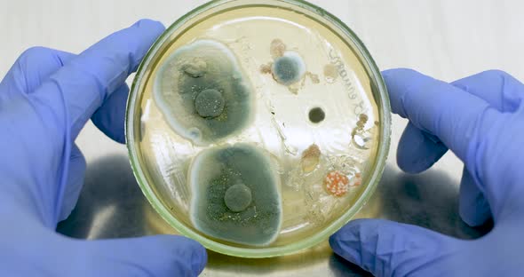 Petry Dish With Bacteria In Hand