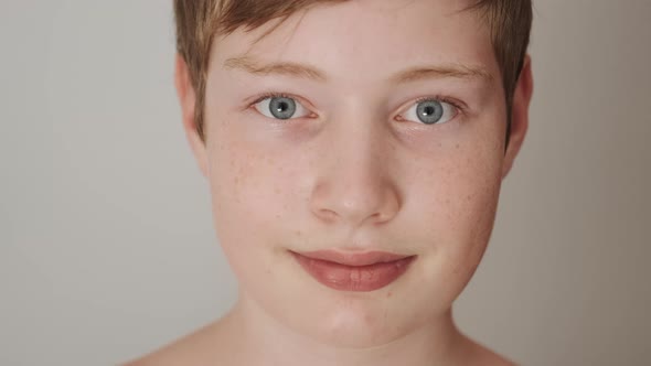 Teenager with Freckles on Face Spots on Skin Smiling and Looking in Camera